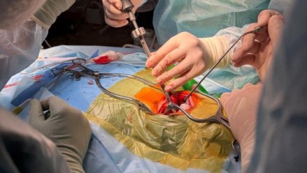 В Коми врачи выполнили уникальную операцию